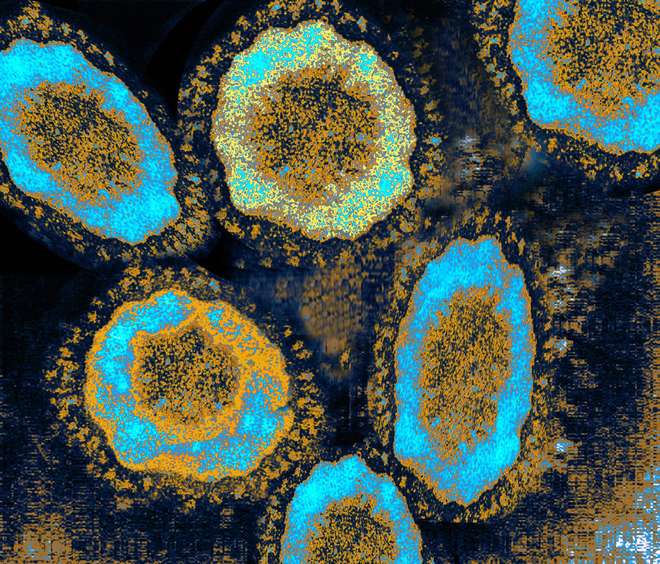 Scanning electron micrograph, coronavirus, linked to SARS (Wellcome Images)