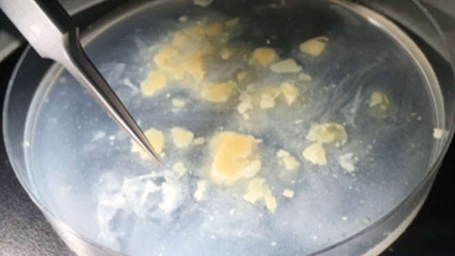 Degraded egg in petri dish