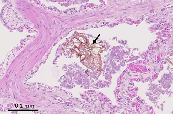 Figure 9 - Histology of a faveolus containing a fragment of foreign material (arrow) surrounded by bacteria. © ZSL